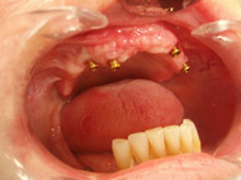 Chirurgia orale e paradontologia